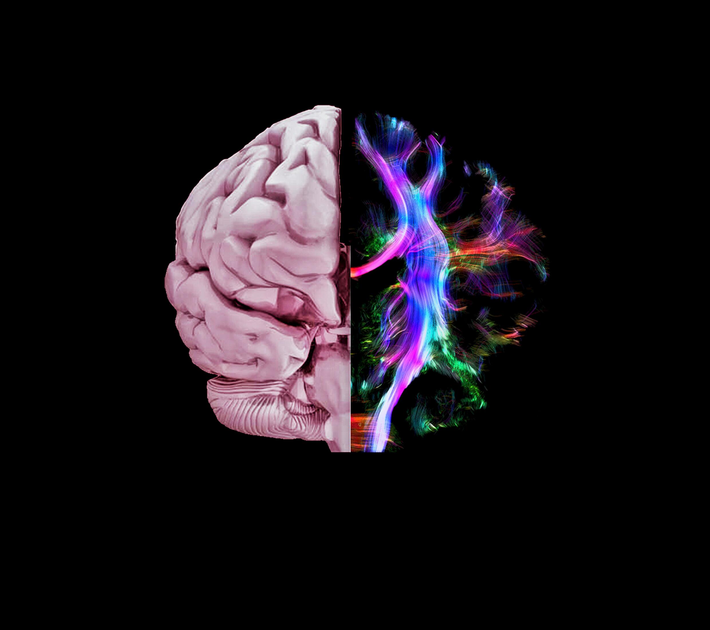 Cerveau d’un jeune adulte. L’hémisphère droit est une reproduction en 3D réalisée à partir de données issues d’un IRM.